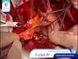 1400.10.15 - عمل جراحی Redo AVR Root enlargement  Septal myectomy