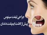 قرص لاغری رزبری کتون تمشک