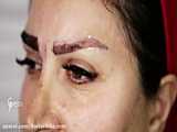 کاشت تخصصی ابرو (09121515595)