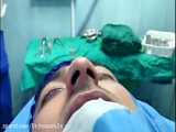 جراحی بینی طبیعی و مردانه