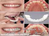 لمینت متحرک دندان - Snap On Smile