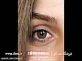 لنز قهوه ای تیره دور دار | 09126223290 | لنزویژن