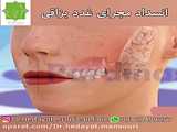 آیا به تعداد دندانهای کشیده شده ایمپلنت لازم است؟ با دکتر هدایت منصوری