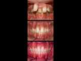 کلینیک دندانپزشکی مهر (mehr_dental_clinic) ارتودنسی دندان