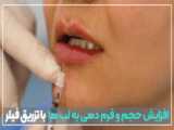 فیبروبلاست تراپی (Fibroblast Therapy) | دکتر اکبر بیات