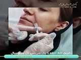 مزوتراپی مو در اصفهان توسط دکتر آتسا اقبال نژاد