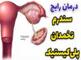 تنبلی تخمدان داری؟ این ویدیو رو ببین