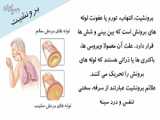 درمان تضمینی و موثر ویتیلیگو، پیسی