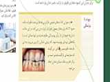 خمیردندان مناسب دندان‌های دارای جرم و پلاک سوپراستار اصفهان بیوتی