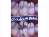 کلینیک دندانپزشکی مهر (mehr_dental_clinic) عصبکشی و ترمیم دندان