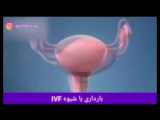 بارداری در اولین IVF در ۴۶ سالگی