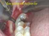 پودرسفیدکننده دندان؛داروگیاهی سلامت09334911527