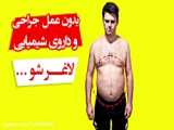 نورومانیتورینگ عمل جراحی Thoracic Disc and PSF