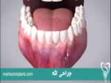 1401.01.24 - روز دندانپزشک گرامی باد