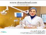 دکتر غزال آرش راد - متخصص ایمپلنت دندان