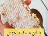 جای جوش،جوش،لک،ضدلک،ضدجوش،