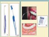 یدک بین دندانی ارال بی Oral B