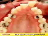 آموزش آرایش مو ساده