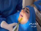 عفونت ایمپلنت دندان و کاشت مجدد ایمپلنت در کلینیک دکتر نصیری