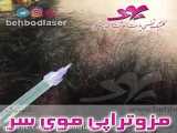 مزوتراپی مو در کرج | کلینیک زیبایی آپیلنس | تقویت مو بانوان و آقایان