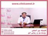 ضد ریزش مو