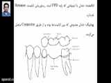 12 نکته کاربردی در مورد قالبگیری دندانی بخش دوم ( دکتر طباخیان )