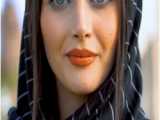 دیگرنیازی به کآشت مو نیست