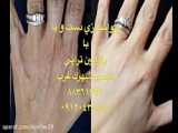 پاکسازی و جوانسازی دست