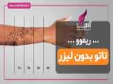 پاککردن تاتو ریموو