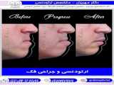 جراحی فک و بینی