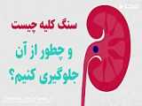 پودردیورتیک؛محصولات سلامت09334911527