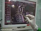فیلم جراحی بینی در یزد توسط بهترین جراح بینی