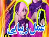 عمل بلفاروپلاسی