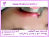 کرم چاق کننده صورت؛محصولات سلامت09334911527