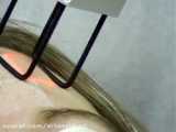 هایفوتراپی (مطب تخصصی پوست مو لیزر موهای زائد کرج)