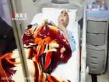 جراحی موفقیت آمیز توده بزرگ ریه در بیمارستان شهید صدوقی یزد