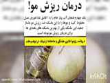 ریزش پشت مو درمان گیاهی
