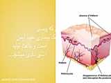 دوره درمان پیسی در سنین مختلف