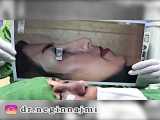 جراحی بینی.           Www.dr-mostafamehri.com