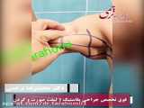لیفت بازو با جراحی