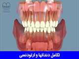 درمان ارتودنسی برای دندان ها