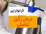 کرایوتراپی زگیل تناسلی.