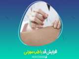 تعداد جلسات طب سوزنی