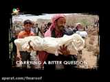 استوری موشن مظلومیت کودکان یمن