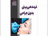 لیفت با نخ در 10 دقیقه