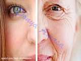 روشهای جلوگیری از پیری زودرس پوست
