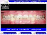 تجربه درمان خانم آقاپور | ارتودنسی دندان