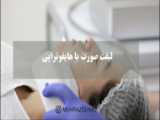 قبل و بعد لیفت سامترال لب