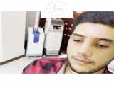 یک هفته بعد از جراحی بینی