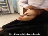 عمل جراحی بینی فیلم